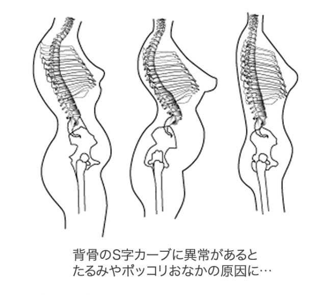 歪みのタイプ