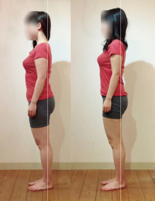 （松山市・下半身痩せ）太ももの前の「お肉」、太もも前の「ハリ」が気になる人は「踵重心気味に立つ癖」をつけてください