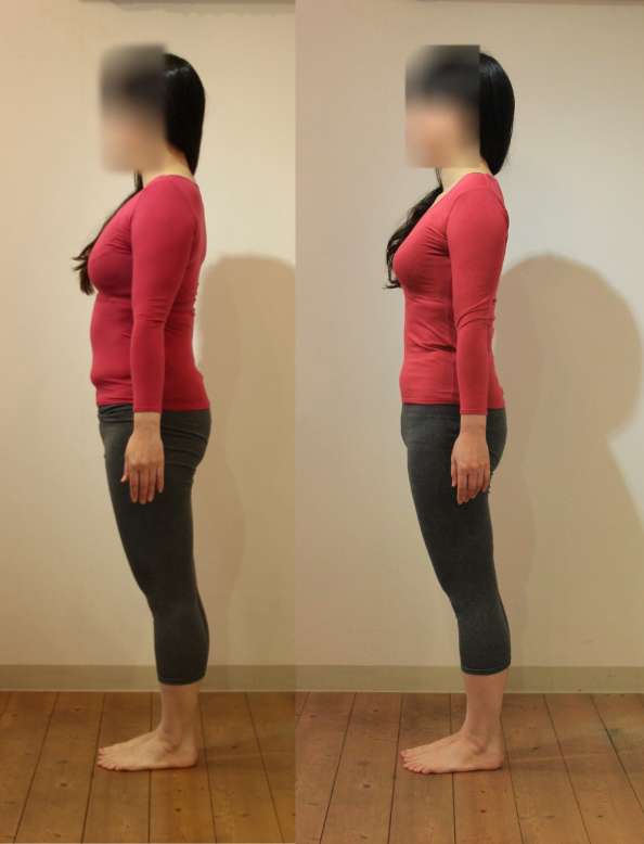 ４０歳代 キレイに痩せて若返った 松山美容整体院