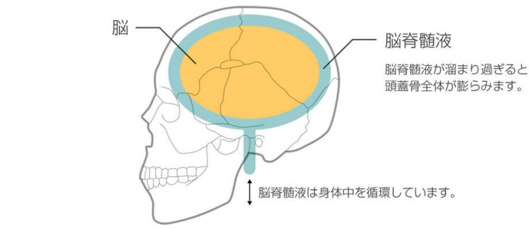 head_01